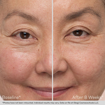 Eyebrow Enhancing & Thickening Serum | Obagi Eyebrow Boosting Serum