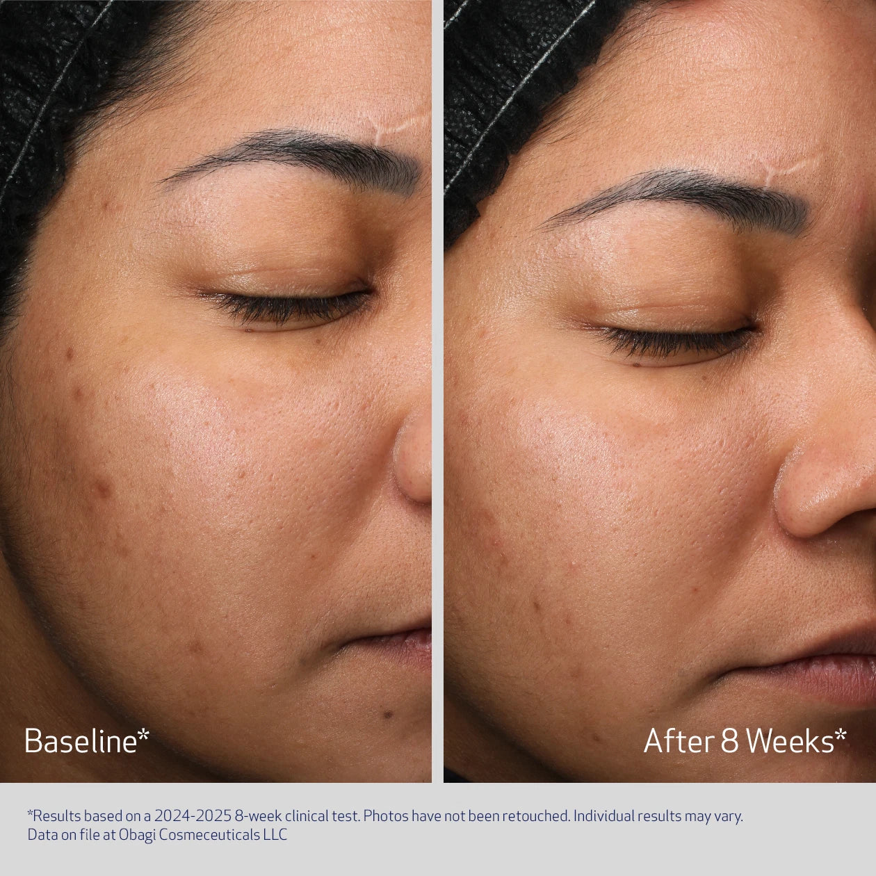 Retinol + PHA Night Cream | Obagi Medical Retinol + PHA Night Cream | Obagi Medical