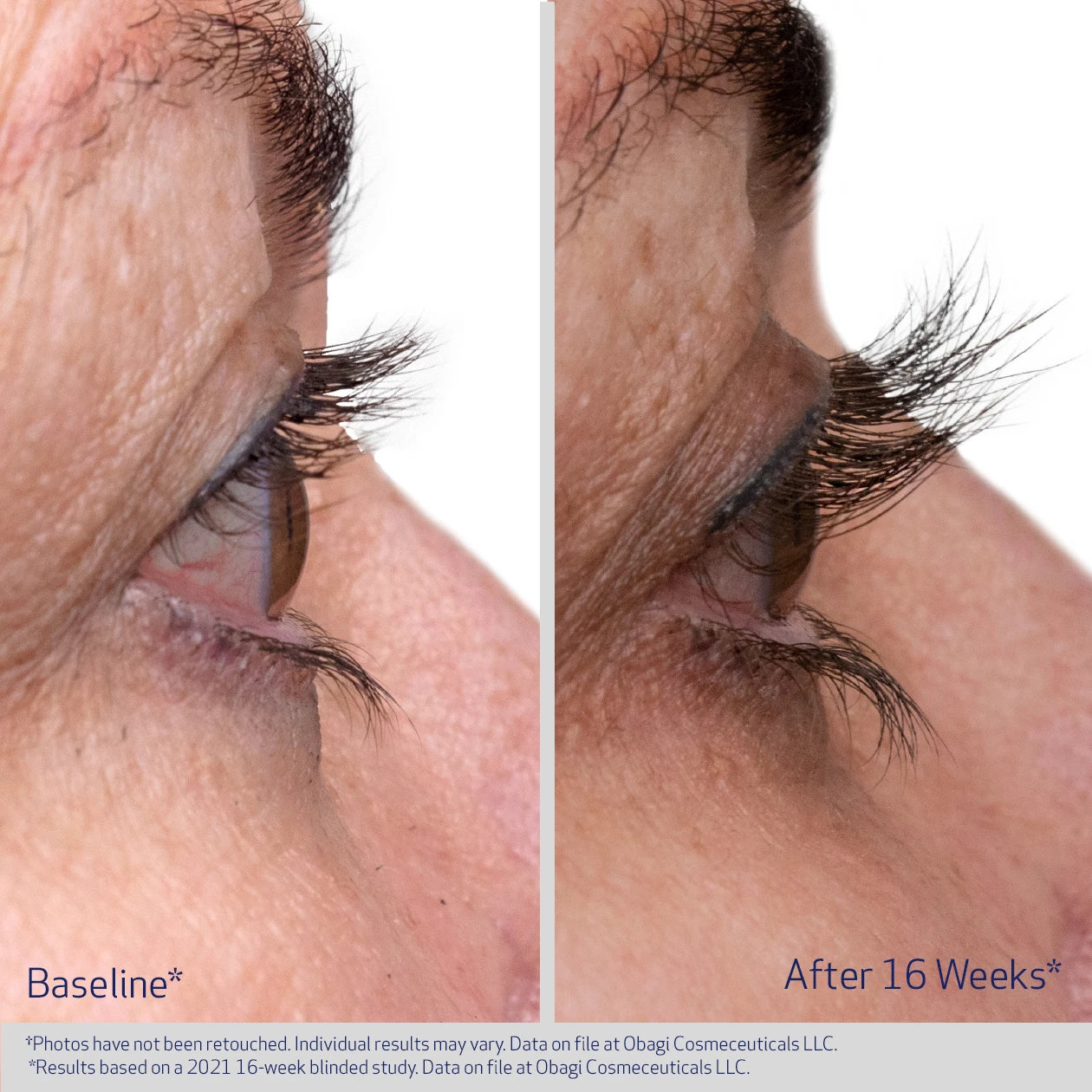 Clinically Proven Lash Serum | Obagi Eyelash Enhancing Serum Clinically Proven Lash Serum | Obagi Eyelash Enhancing Serum