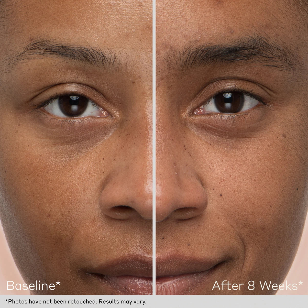 Obagi Lash and Brow Serum Set Before and After Model Image