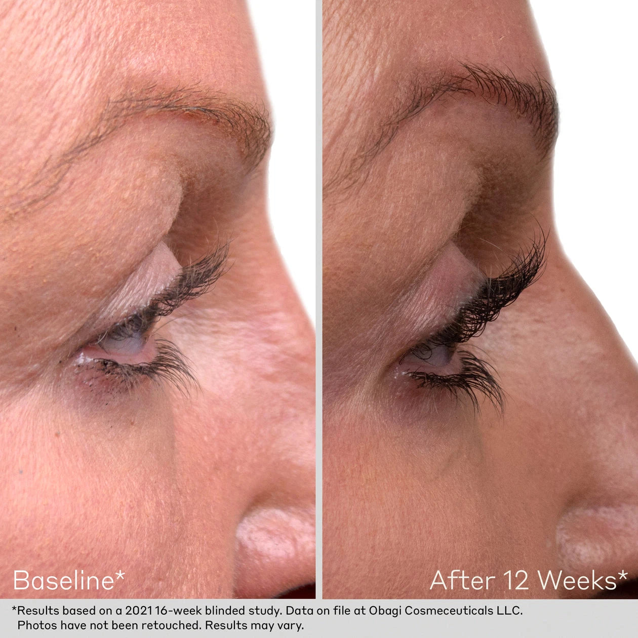 Obagi Lash and Brow Serum Set Before and After Model Image